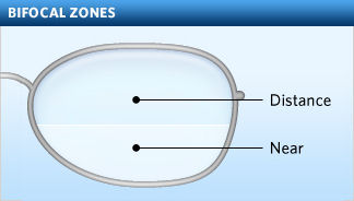 Bifocal Lens Example